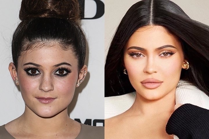 30+ Celebrities Who Spent A Fortune Altering Their Looks