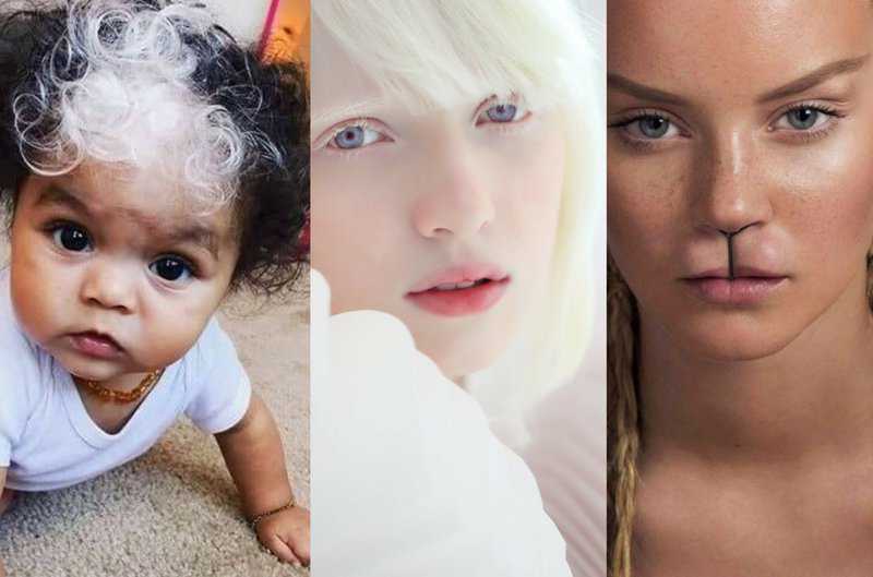 Unveiling the Fascinating Power of Genetics through Real People’s Photos